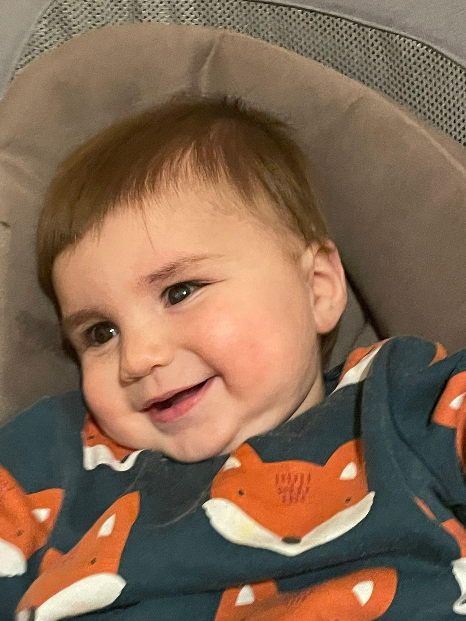 The 10-month-old has a rare genetic condition called Norrie Disease which causes blindness and progressive hearing loss.