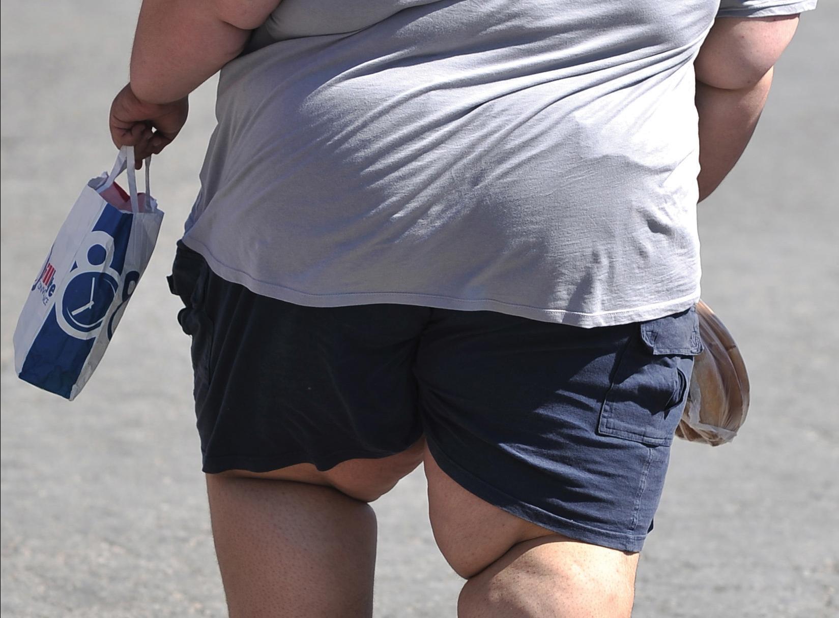 Malta tops the obesity charts. Photo: Chris Sant Fournier