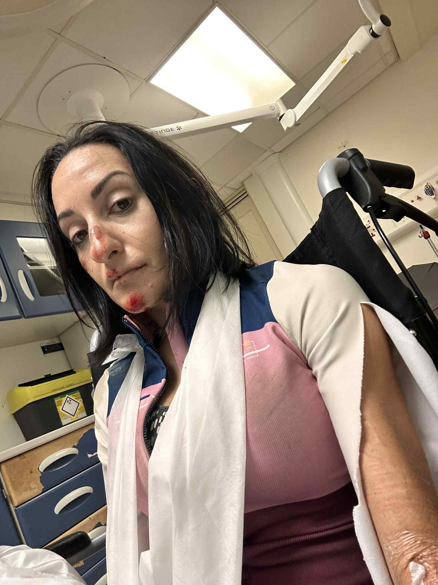 Triathlete Lena Sammut broke her collarbone when she fell off her bicycle on the double speed bumps in December.