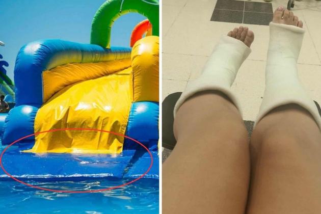 Water park under fire after woman claims she 'shattered' feet on its slide