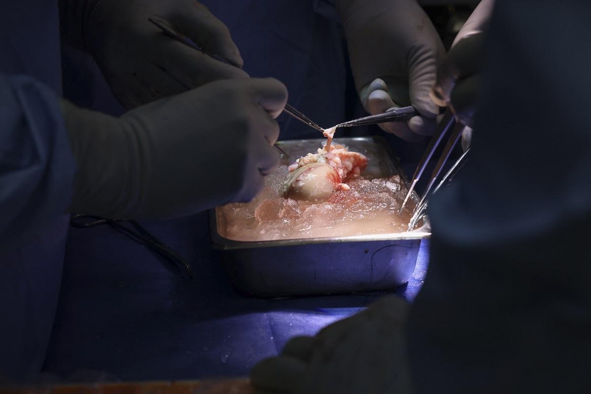 Surgeons prepare the pig kidney for transplantation during the world&rsquo;s first genetically modified pig kidney transplant into a living human. AFP